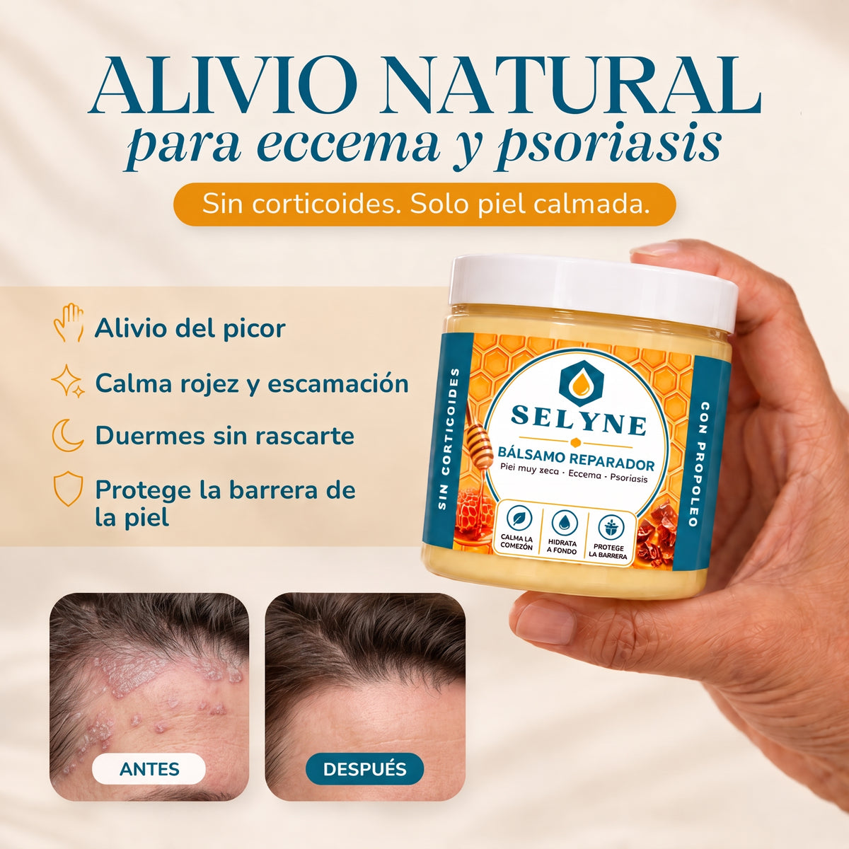 Bálsamo Reparador para Psoriasis y Eccema