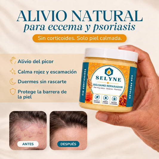 Bálsamo Reparador para Psoriasis y Eccema