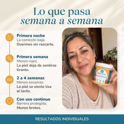Bálsamo Reparador para Psoriasis y Eccema